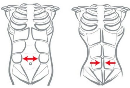 Flacidez na barriga: será que é diástase